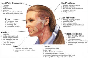 Treating TMJ Physiotherapy